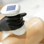 Understanding Cryolipolysis for Non-Invasive Body Contouring