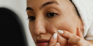 Bad Pimple Pricking: Why Self-Extraction Harms Skin
