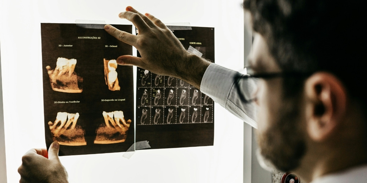 Choosing Between Pulp Capping and Root Canal